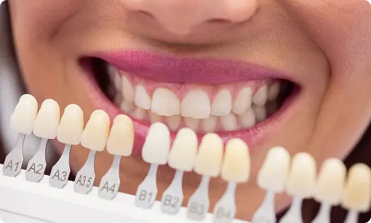 Why Choose Tooth Whitening